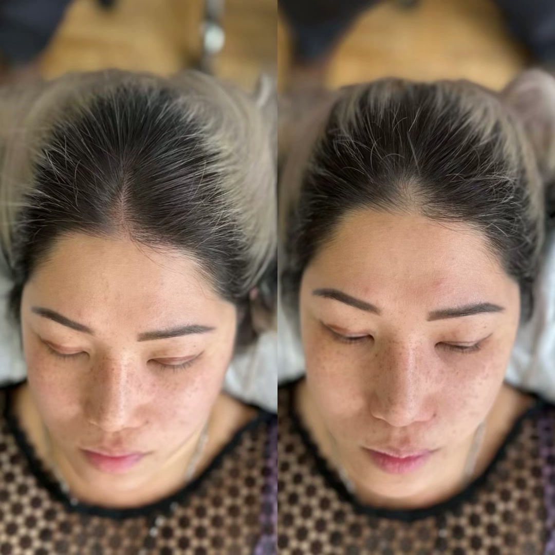 Scalp treatment detail